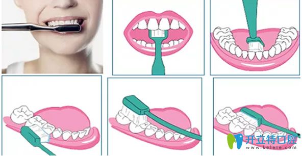 刷牙的正確方法