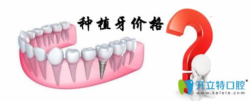 通過(guò)重慶種植牙價(jià)格表來(lái)揭秘重慶種植牙多少錢(qián)一顆？