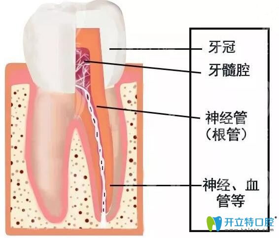 牙神經(jīng)壞死怎么治療及治療價(jià)格，你知多少？