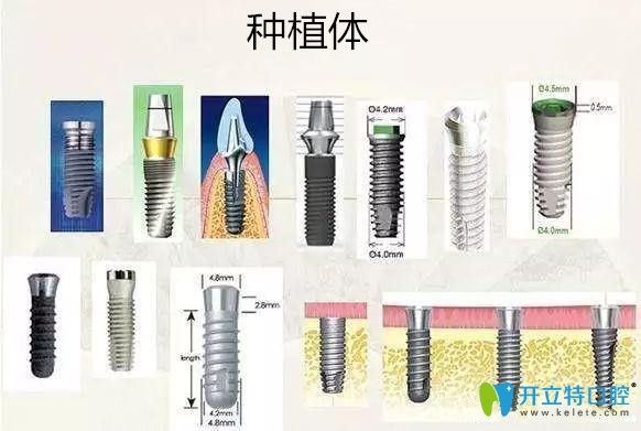  談談種植牙價格便宜和貴的有什么區(qū)別？