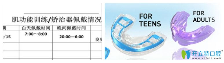 維樂口腔佩戴記錄表和兒童矯正器圖示