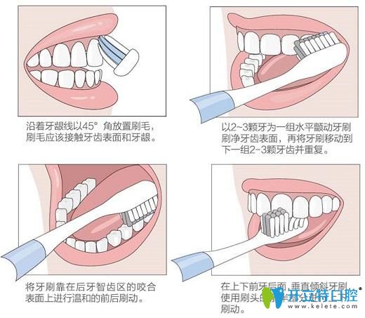 刷牙方法