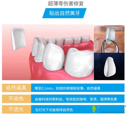 拜爾口腔E-max鑄瓷貼面