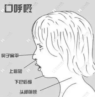 兒童的不良習(xí)慣會(huì)導(dǎo)致長得不好看