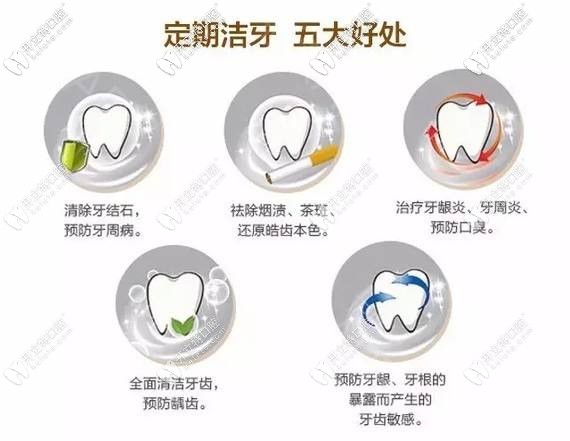 定期潔牙的好處