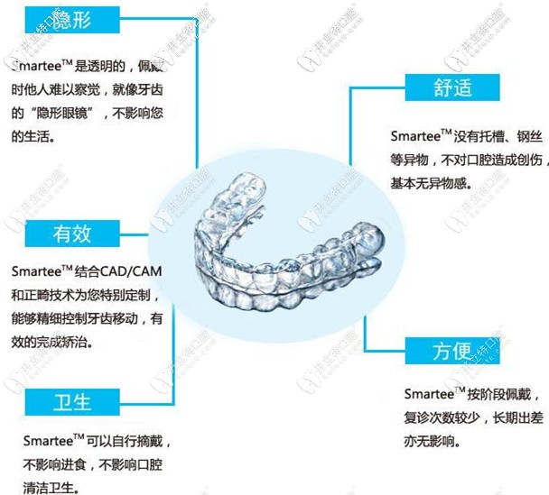 隱形矯正的特點(diǎn)