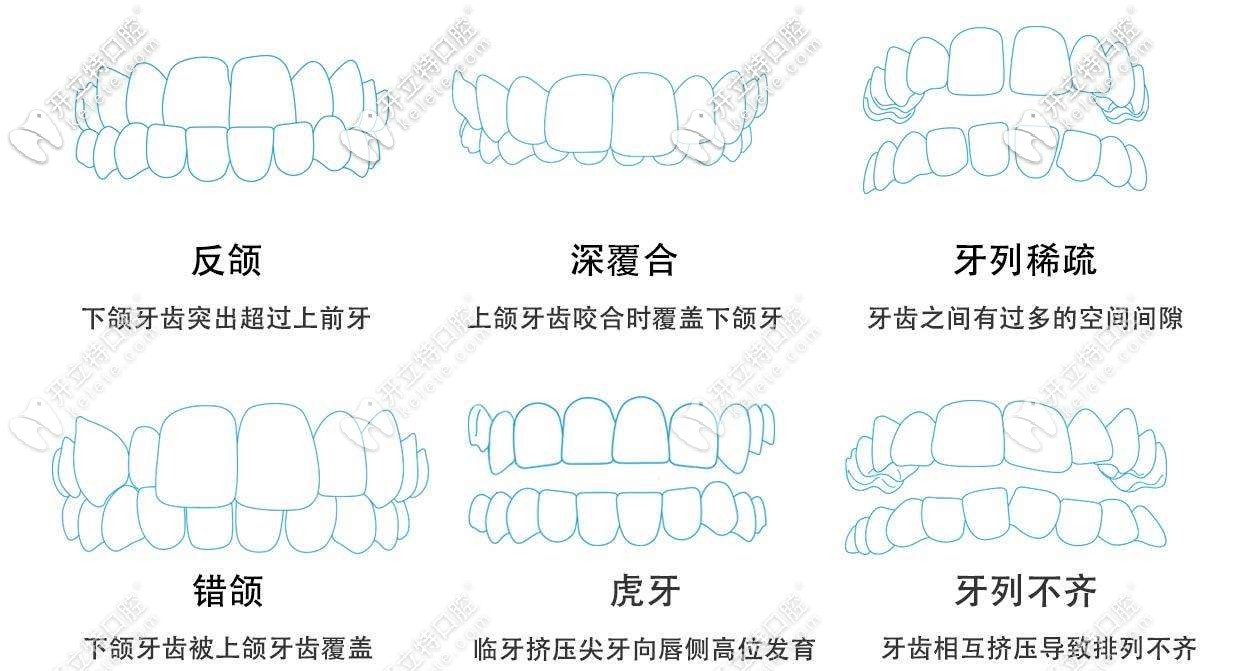 時代天使可適應(yīng)病例