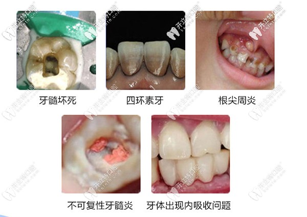 重慶全口疑難種植牙醫(yī)院排名前十,含渝北區(qū)/九龍坡種牙醫(yī)院