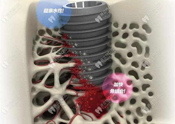 UV Active植體的親水性演示