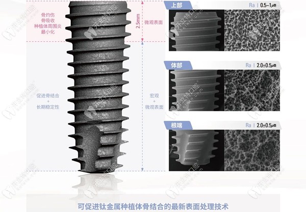 UV Active植體的表面處理技術(shù)